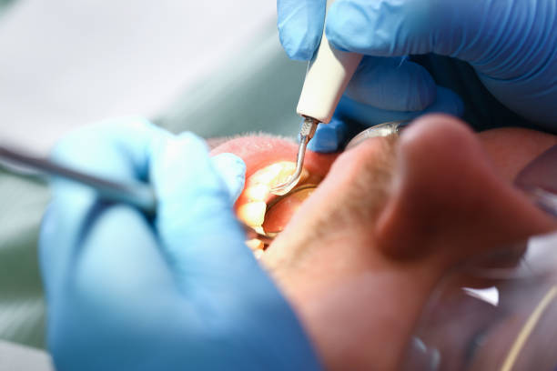 Best Pediatric Emergency Dentist in Diamond Bar, CA