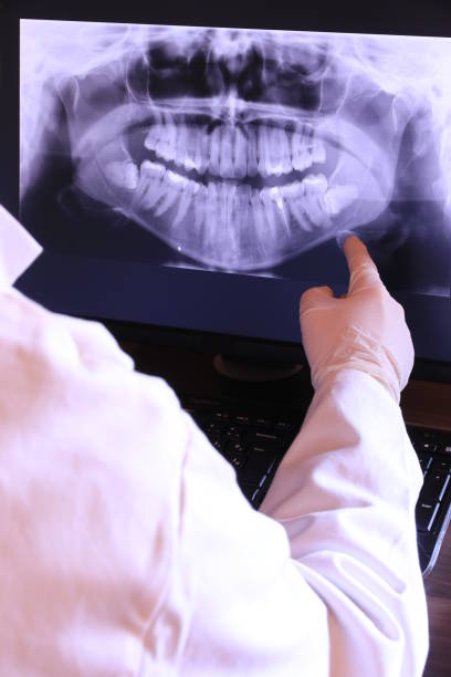 Best Emergency Dentist for Lost Fillings or Crowns in Diamond Bar, CA